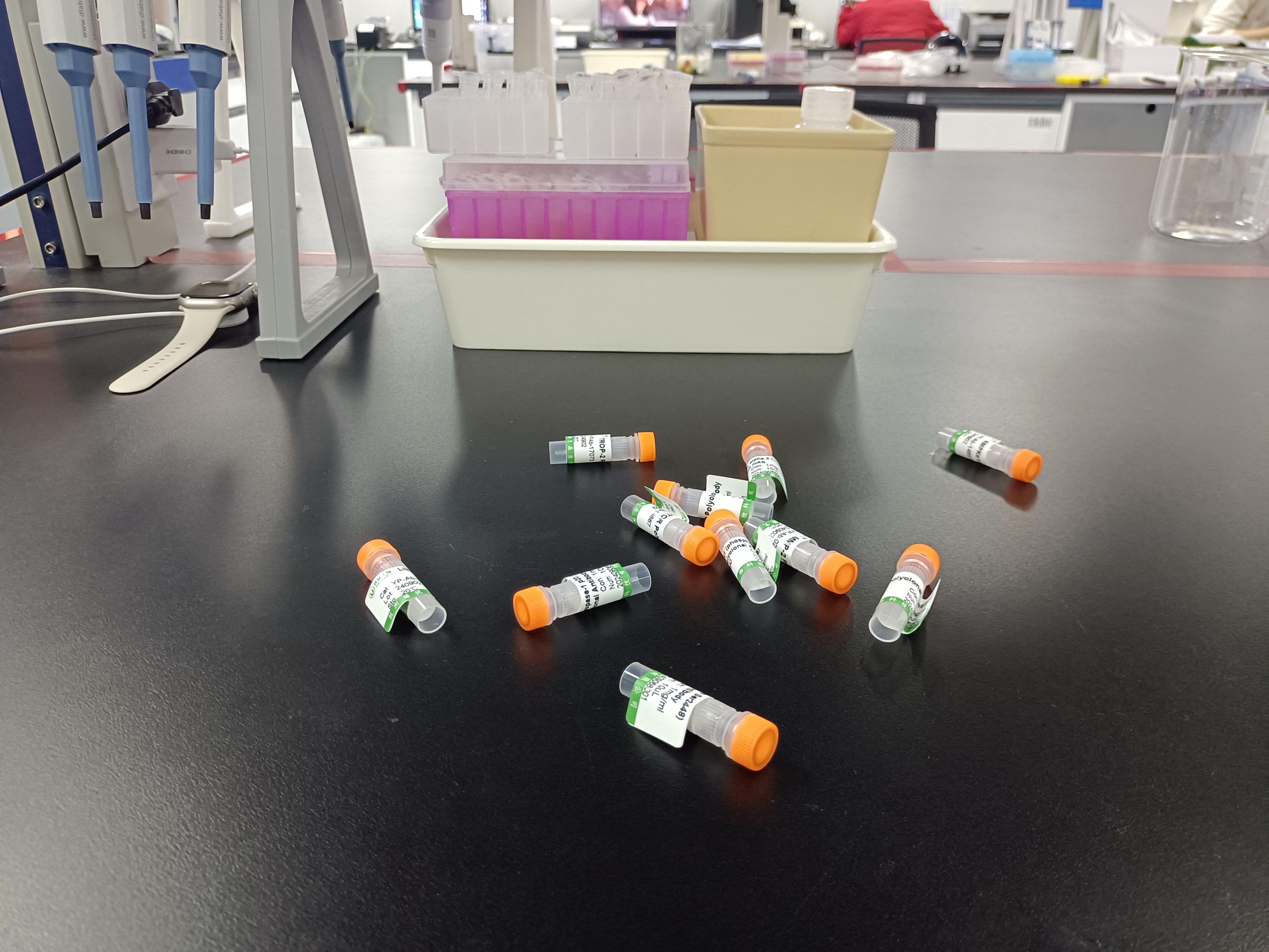 优品生物人抗双链 dna 抗体试剂盒,引领高效检测新时代