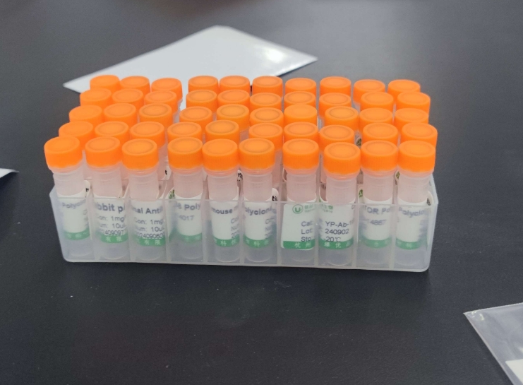 高效检测:优品生物人抗双链 dna 抗体试剂盒