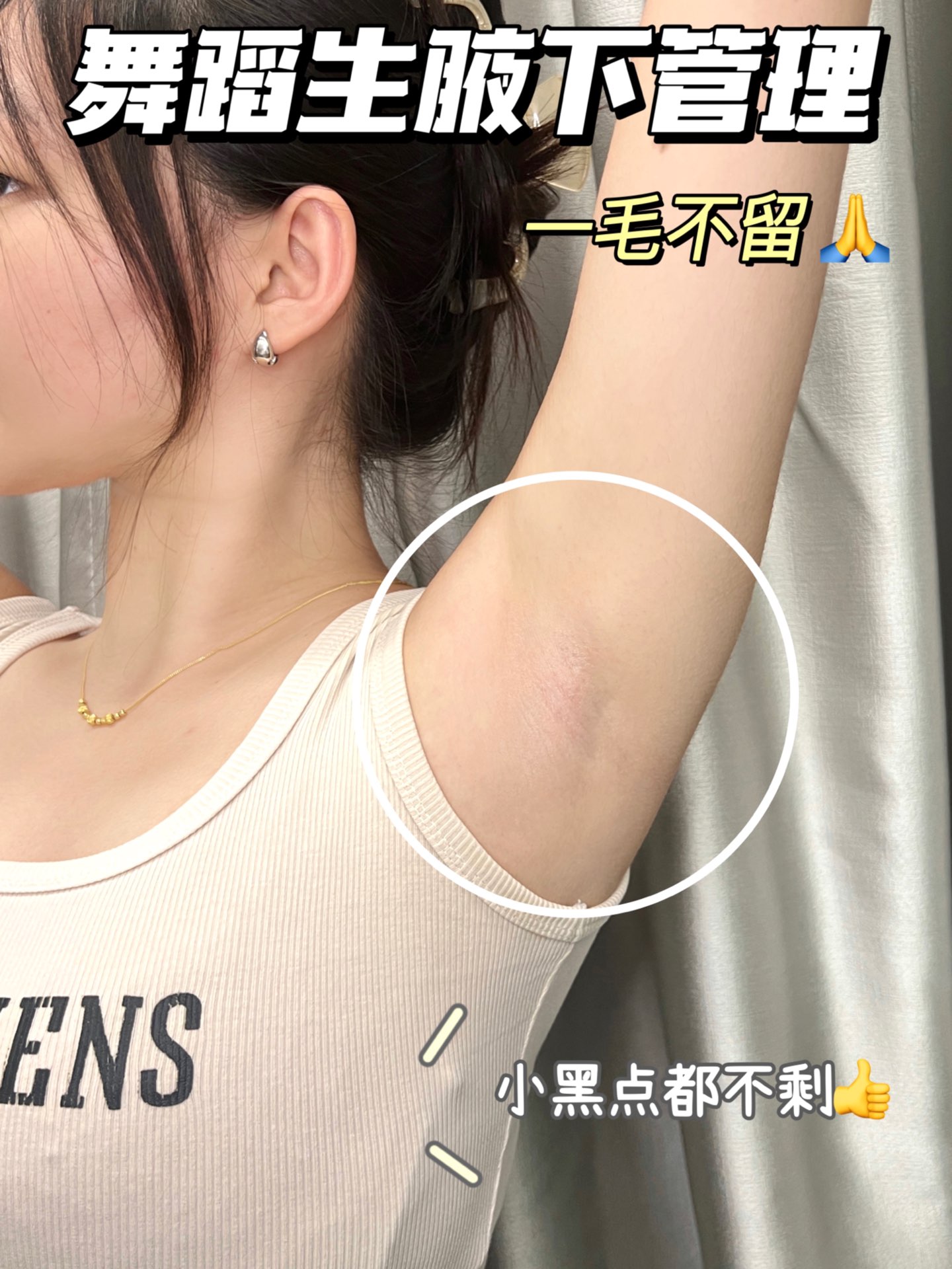 为什么女生要脱毛