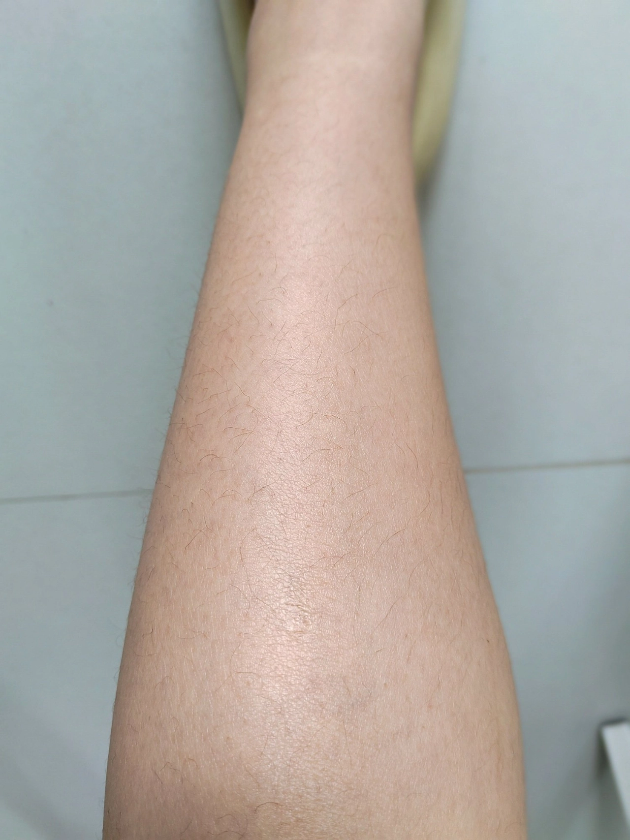 但是天生多毛的我真的太让人糟心了,腿毛是又多又长,都给我整自卑了