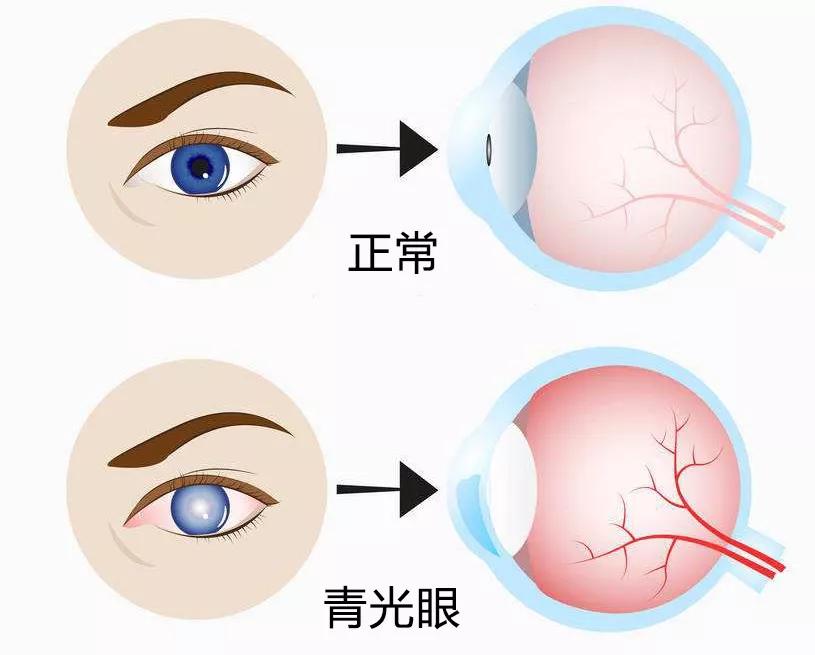 眼睛灰线位置 图图片