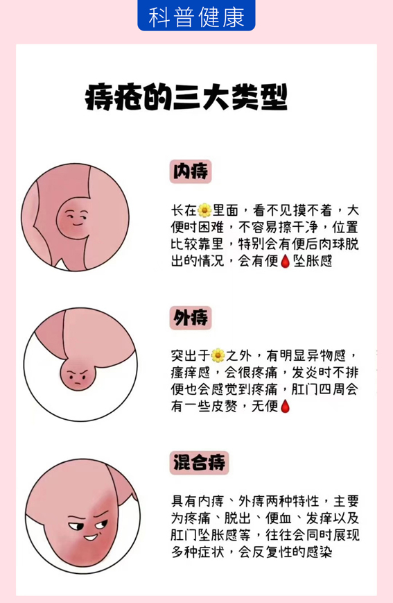 女性得痔疮怎么办?教你几个应对方法