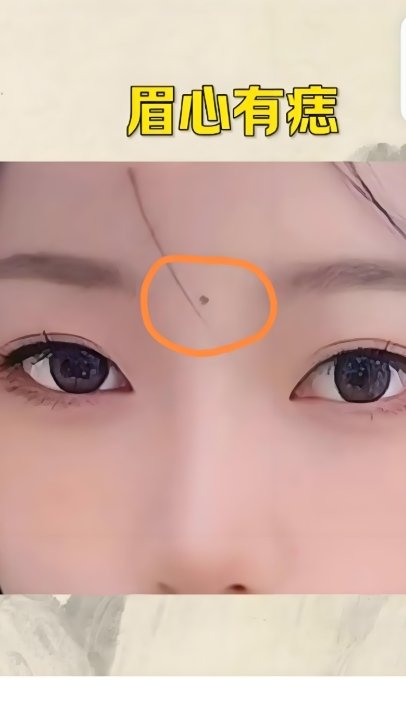相书称这是"观音痣",一生有贵人相助