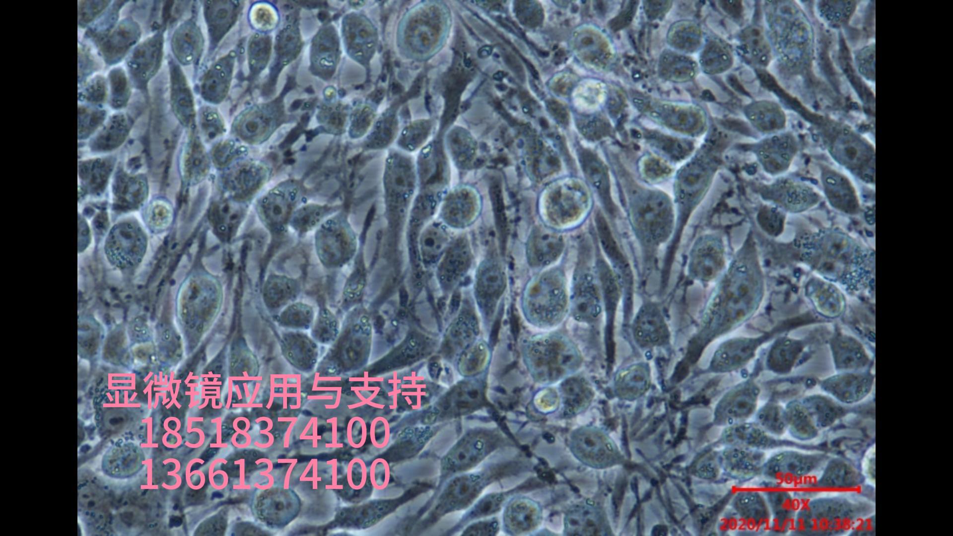尼康ts2显微镜 lv2000相机 动物所拍细胞