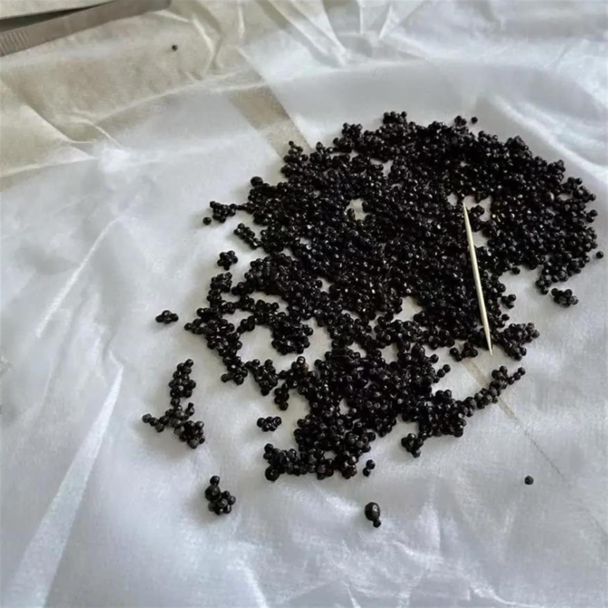 防结石需注意饮食,多吃粗粮蔬果,适度运动,保持良好情绪.