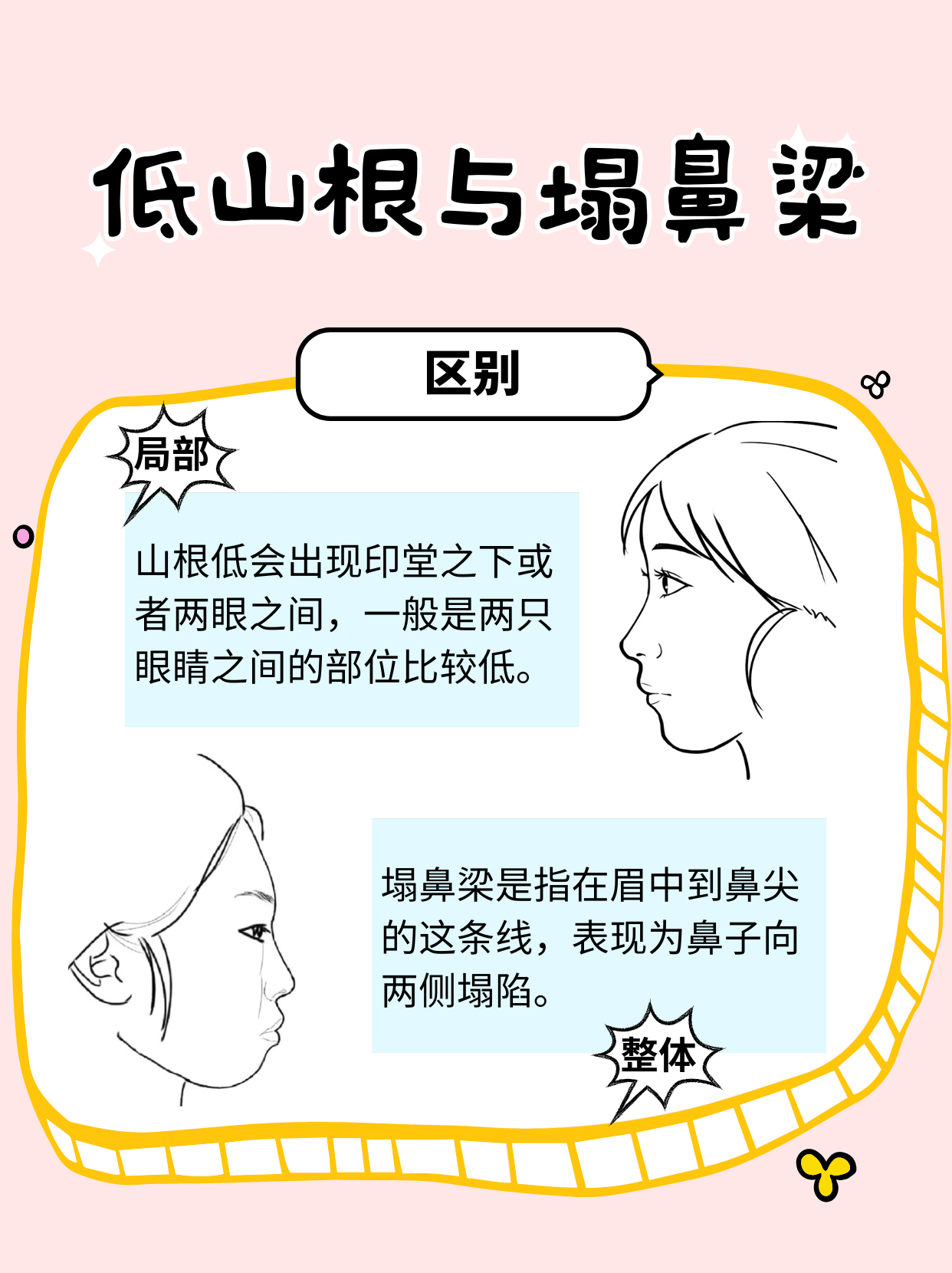 山根低和塌鼻梁的区别