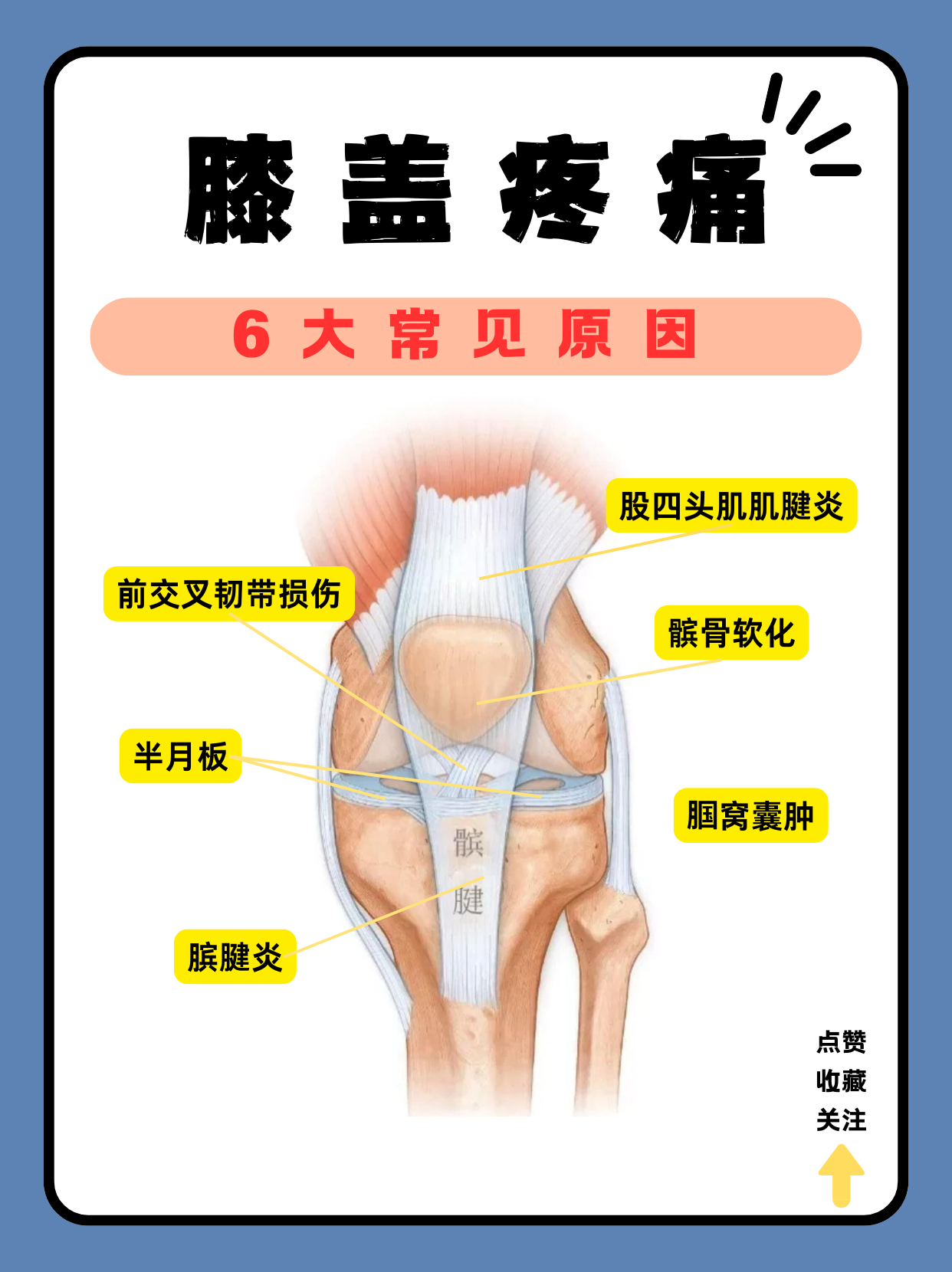 膝盖疼痛6大常见原因