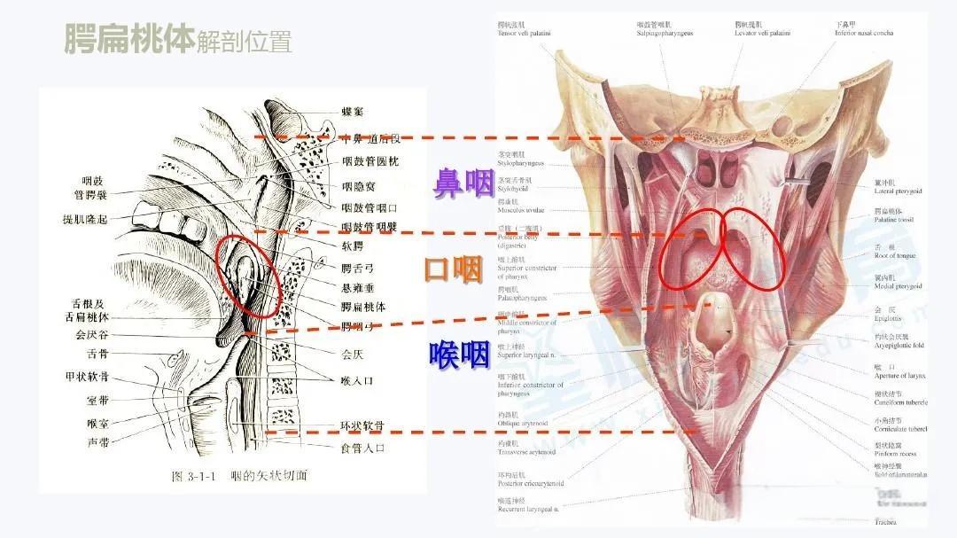 咽痛喉咙痛咽炎扁桃体炎何时使用抗菌药