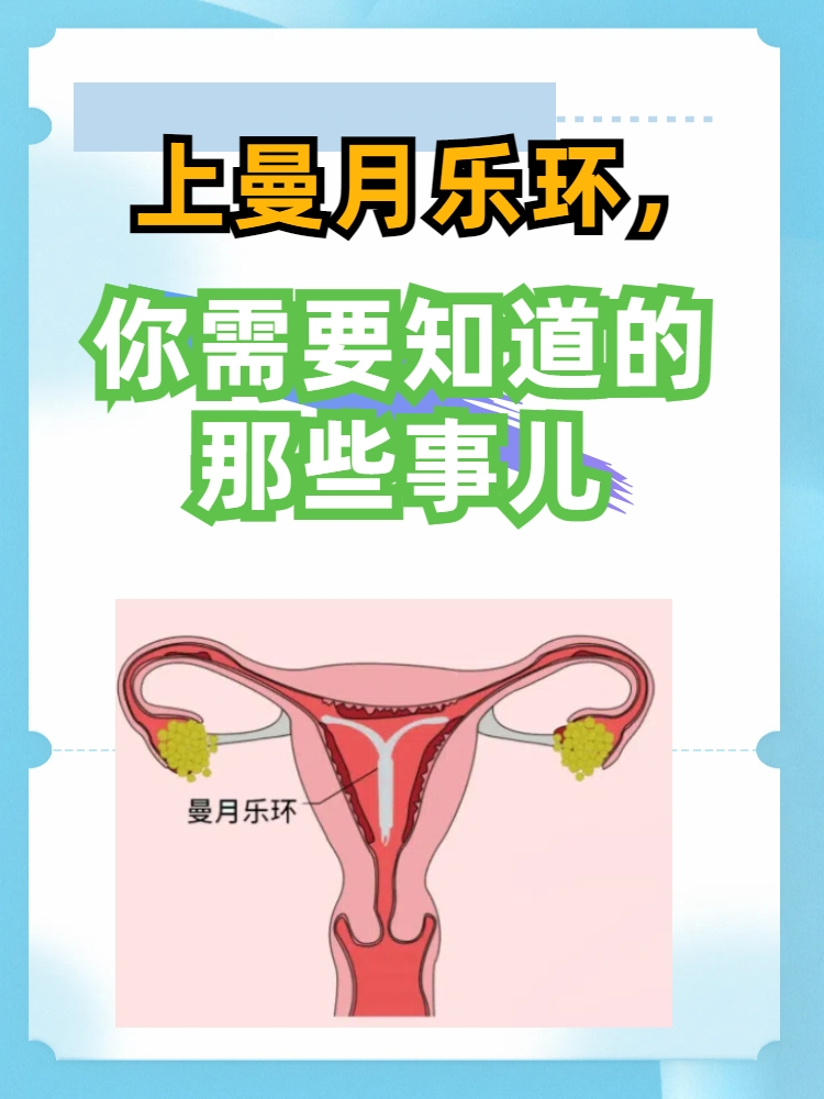 曼月环能避孕,还可缓解痛经,减少经量