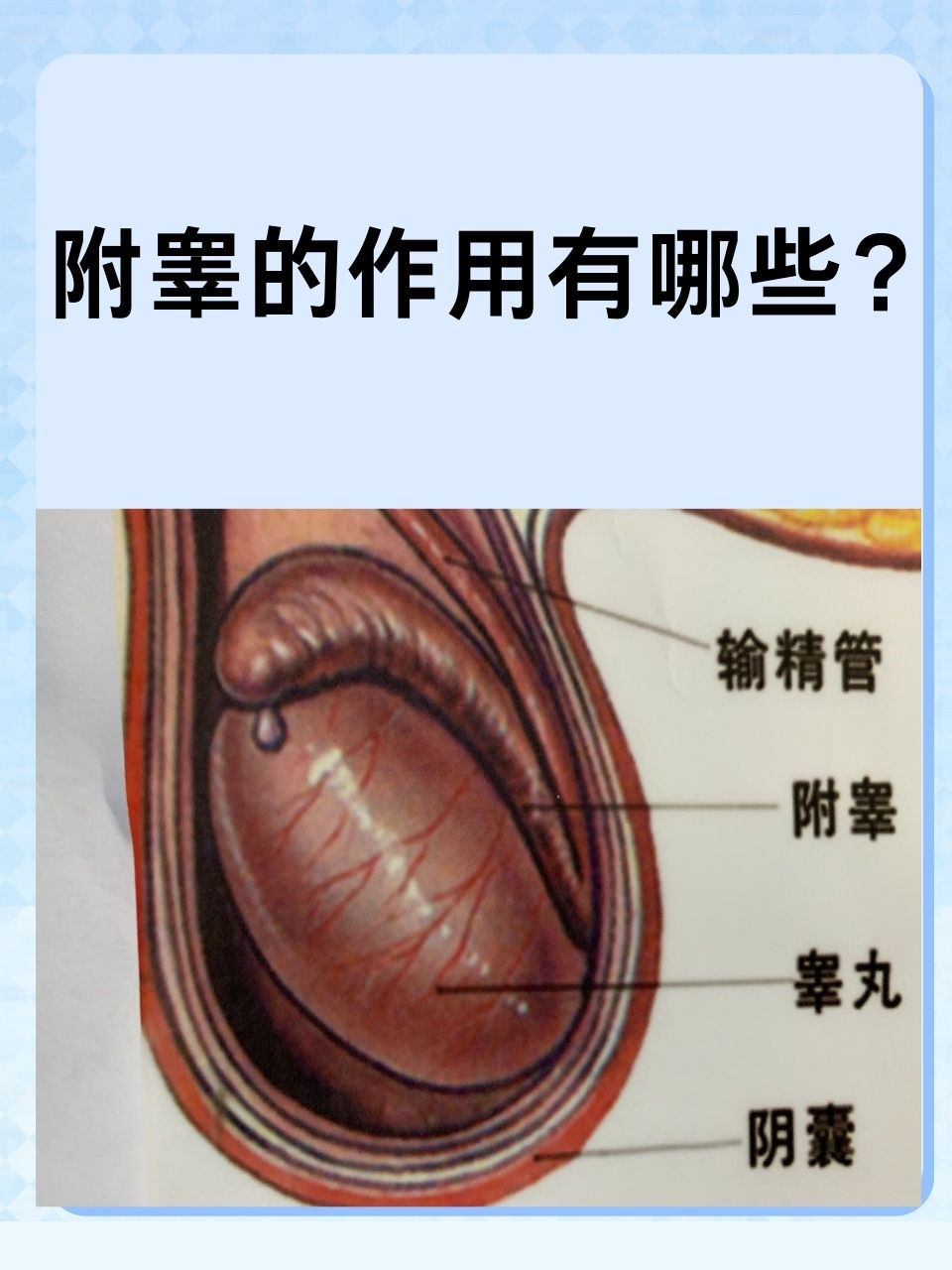 附睾尾部图片