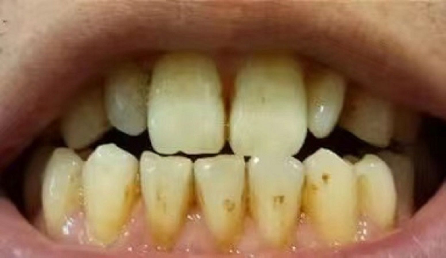 牙黄,口气重?刷来刷去没变化?试试这只"能调色"的牙膏!