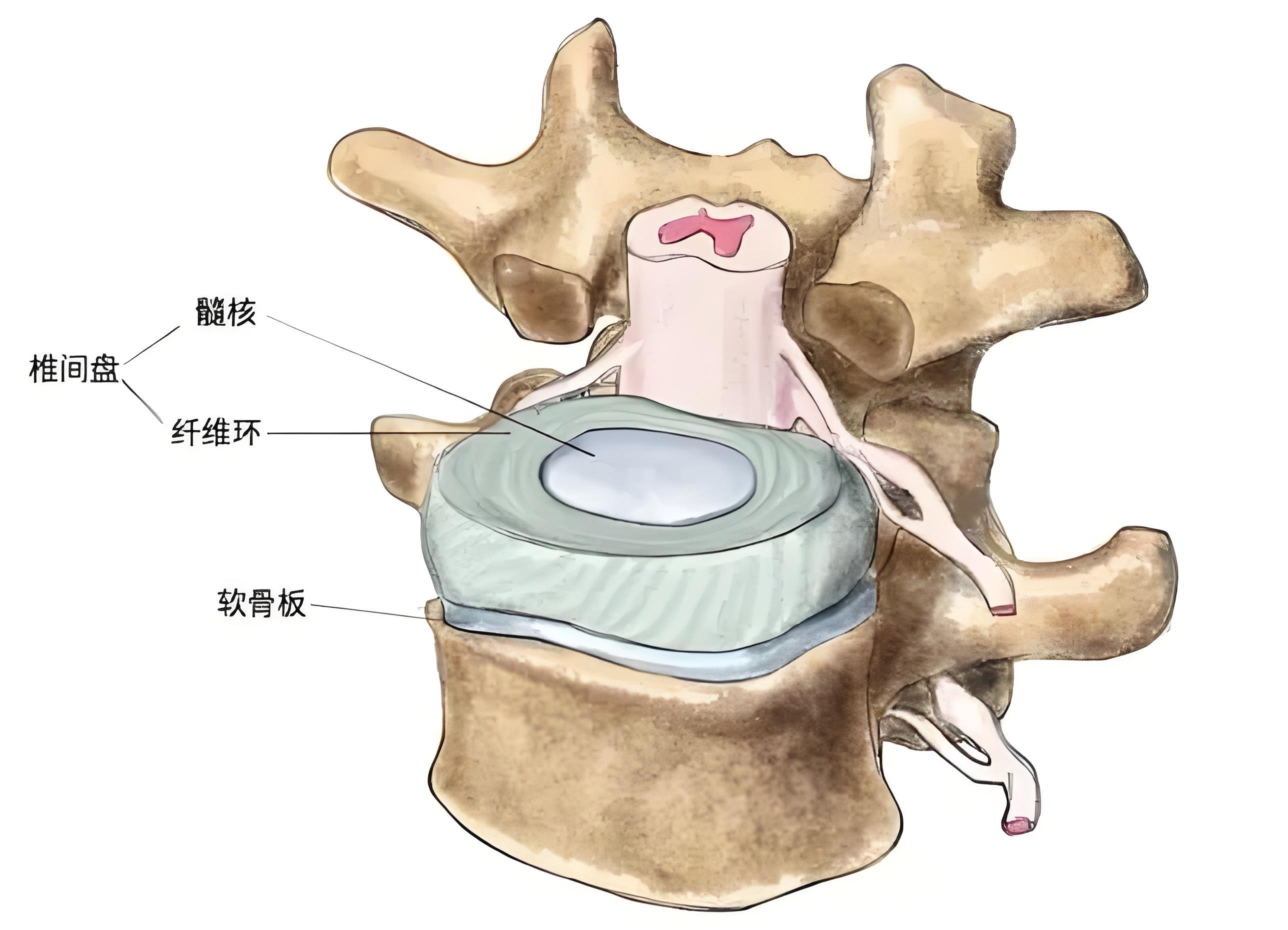 腰椎间盘突出手术后,饮食要注意这几点