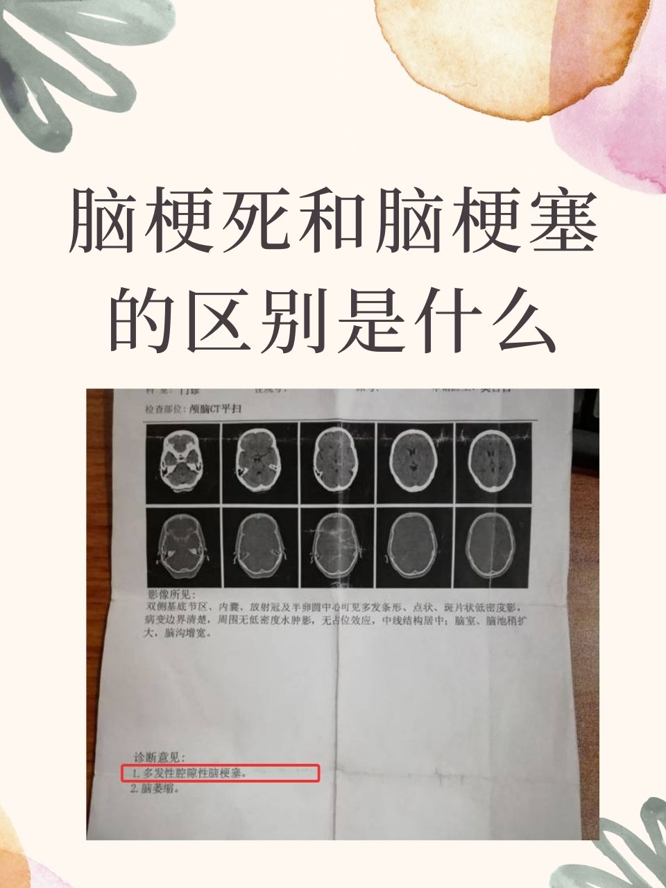 为什么会脑梗塞呢百科在线