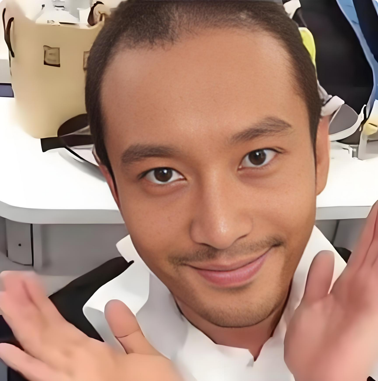 这才是真实状态下的黄晓明,不戴假发的他头发稀疏脱发严重!