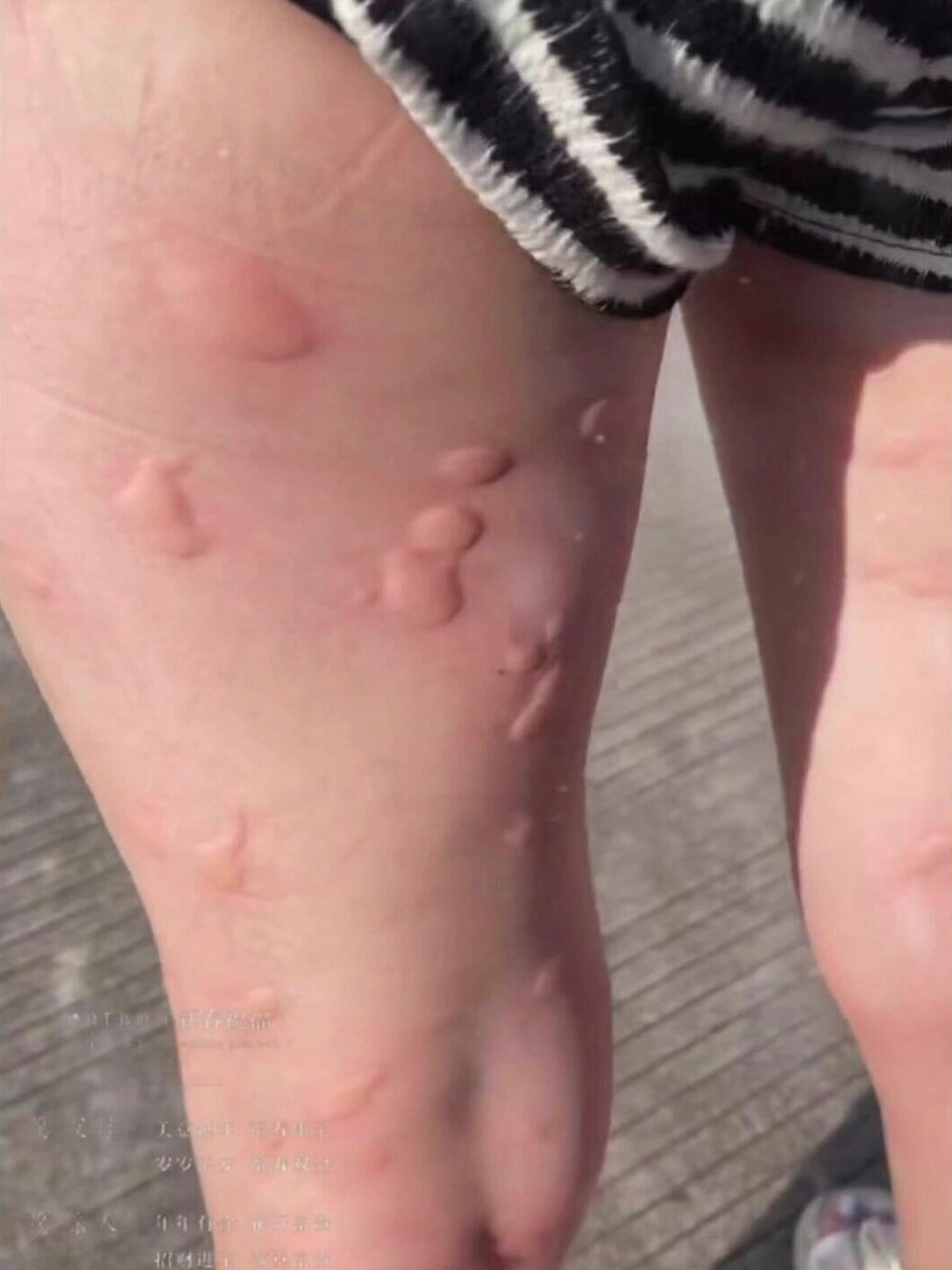 每年天气稍微热一点,蚊虫都出来了,光是点蚊香效果不大