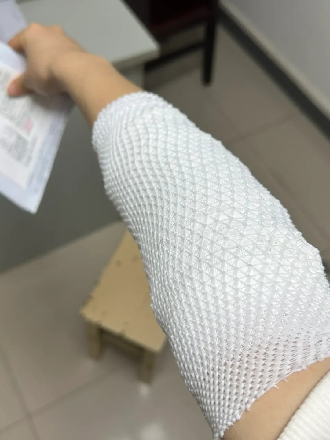 网球肘不要轻易自我复健