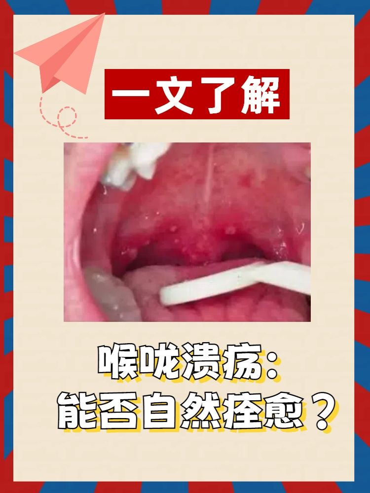 喉咙长溃疡 baijiahao.baidu.com