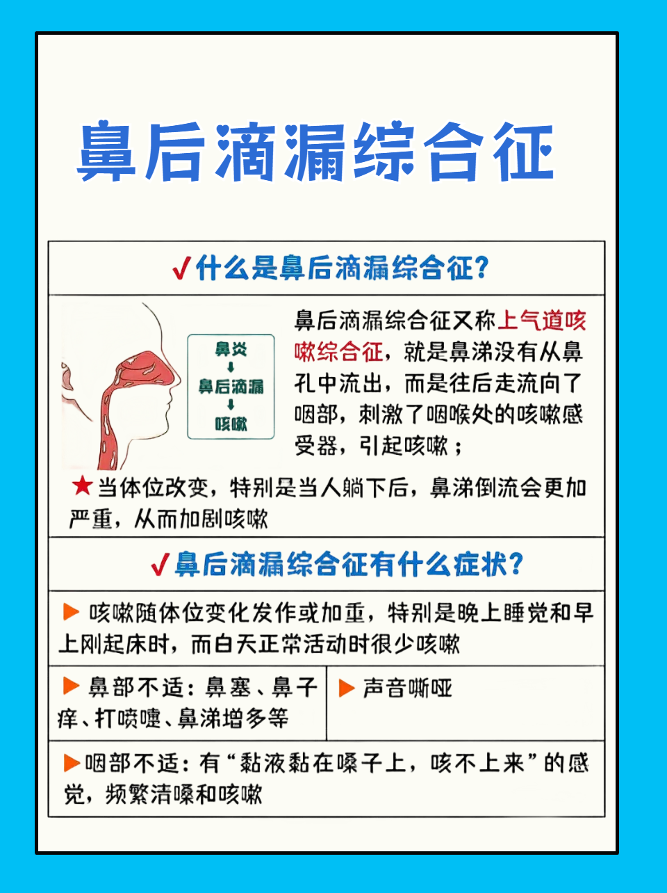 鼻后滴流图片