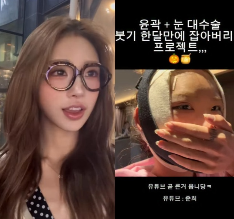 已故崔真实之女崔俊熙公开整形术后惊人变化，V脸成型引全网热议