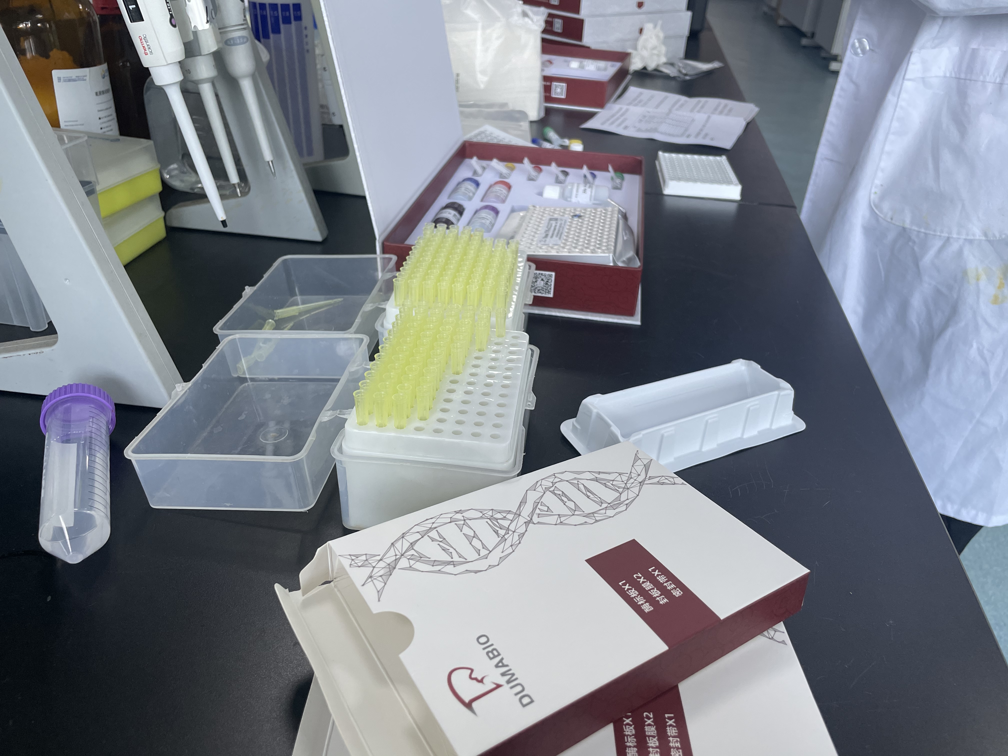抗β2糖蛋白1IgM抗體(β2-GP1IgM)測定試劑盒IVDD辦理