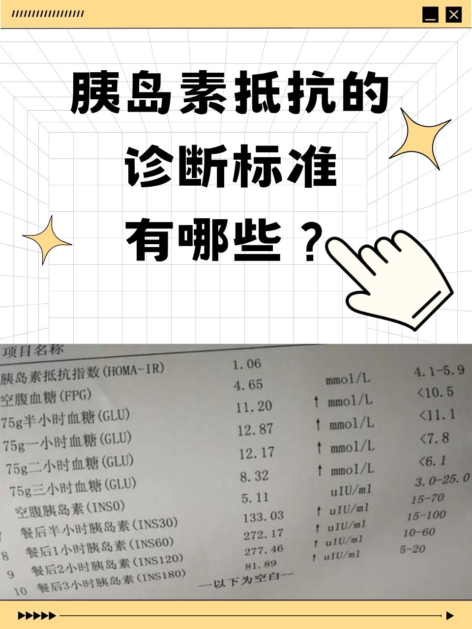 胰岛素抵抗的诊断标准有哪些?