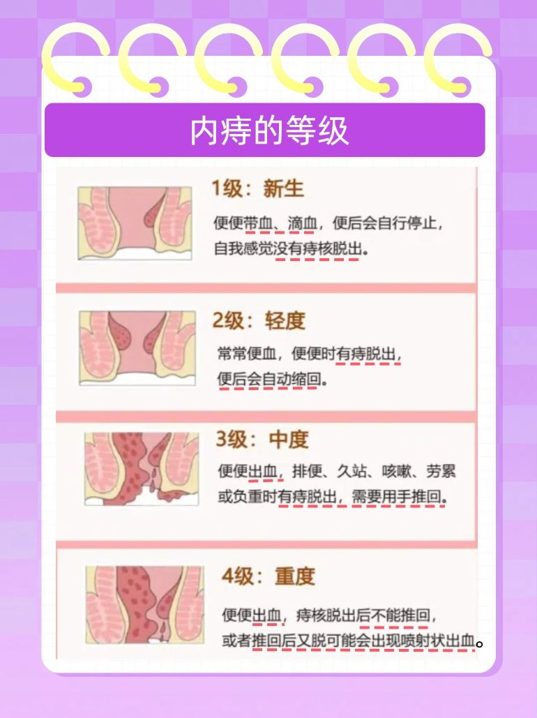 正常肛门 痔疮图片