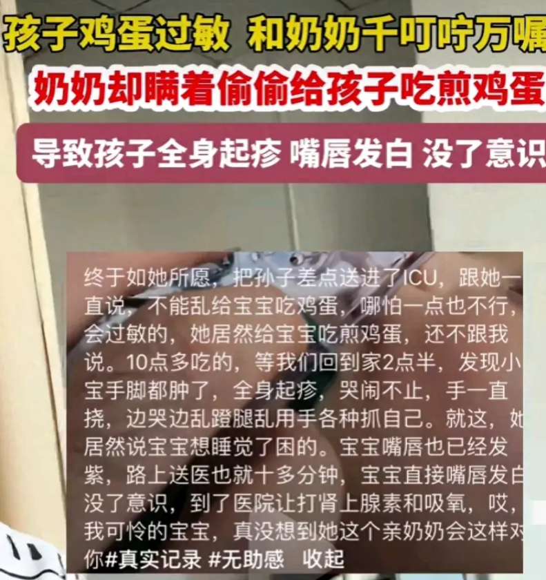 不听劝!宝宝吃鸡蛋过敏奶奶不听劝偷喂,家长:差点进icu