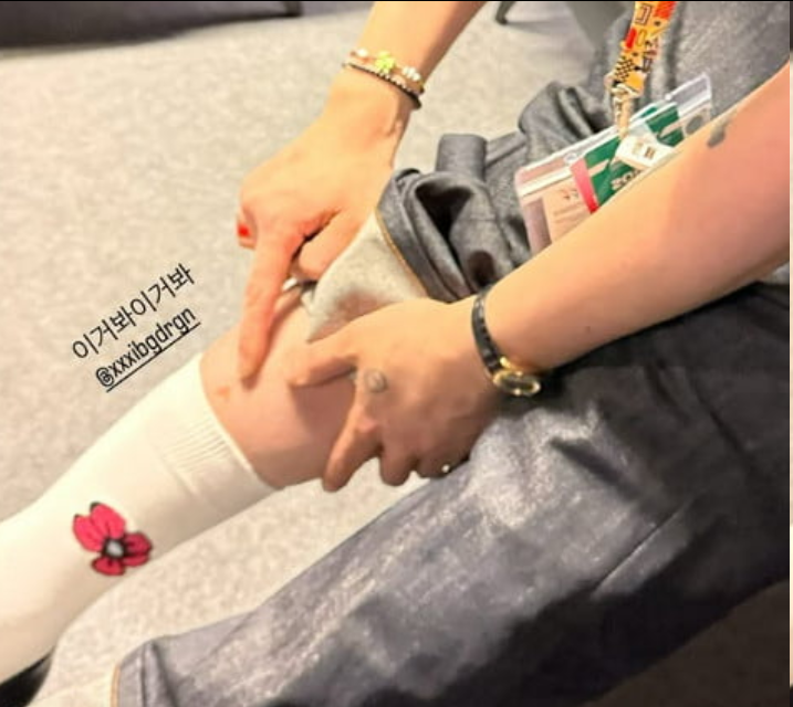 G-Dragon自曝身上“爱心胎记”，意外揭开可爱身体秘密！