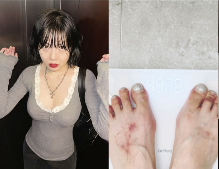 泫雅澳门晕倒后首回应：自曝“记忆空白”，曾月减10公斤暴瘦史引担忧