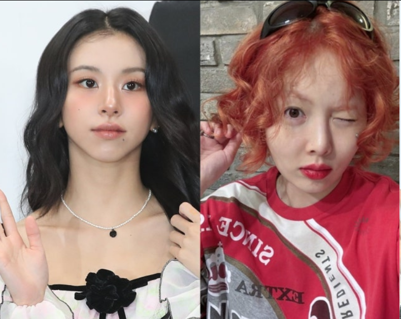 TWICE彩瑛、泫雅接连诊断“迷走神经性昏厥”，症状与预防方法是什么?