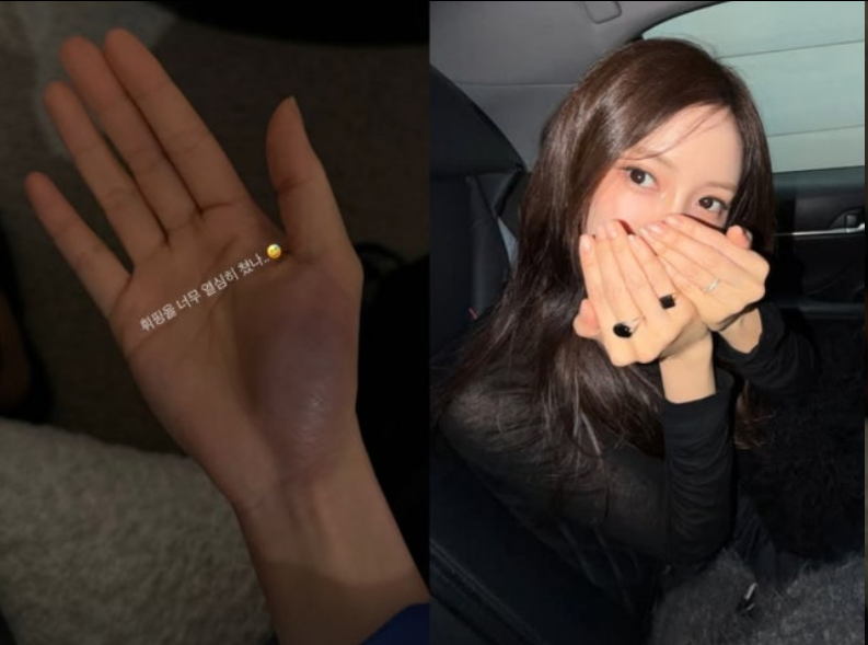 T-ara孝敏为招待客人苦练厨艺，晒出掌心大片淤青