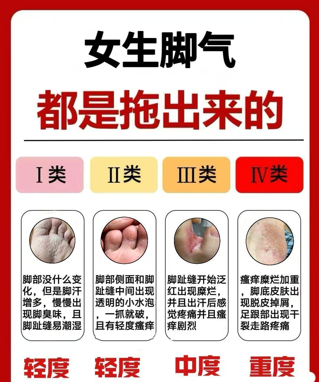 脚气真的能根治吗?亲测古法让人意外