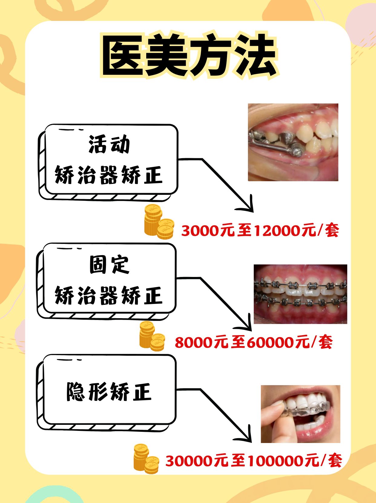 地包天矫正价格表图片