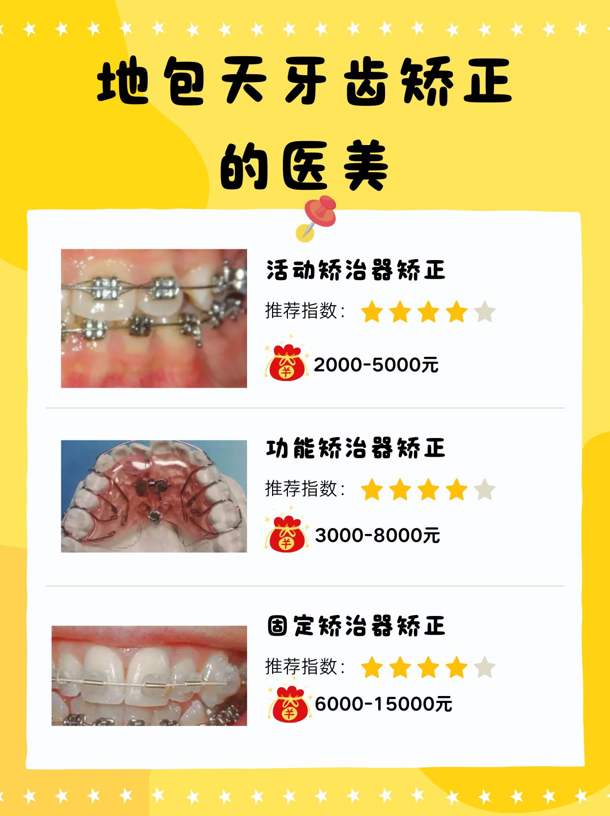 地包天矫正价格表图片