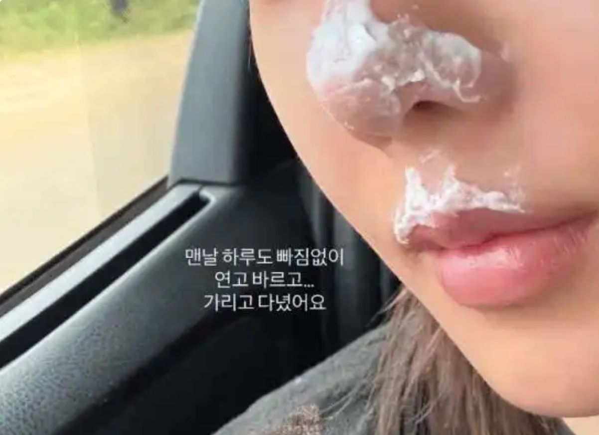 权恩妃在攀登乞力马扎罗山后，鼻部与唇部遭受了二度烫伤