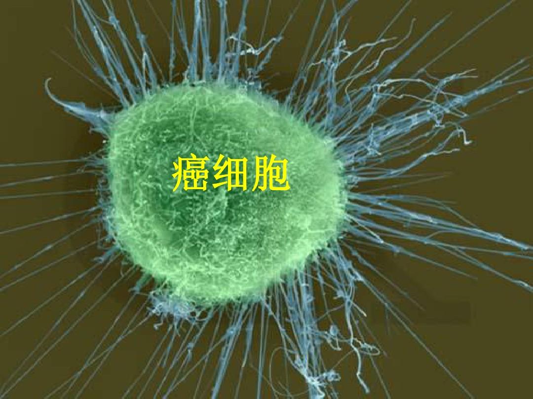 人人都有癌细胞,为啥没有人人得癌?原来癌细胞喜欢你干这4件事
