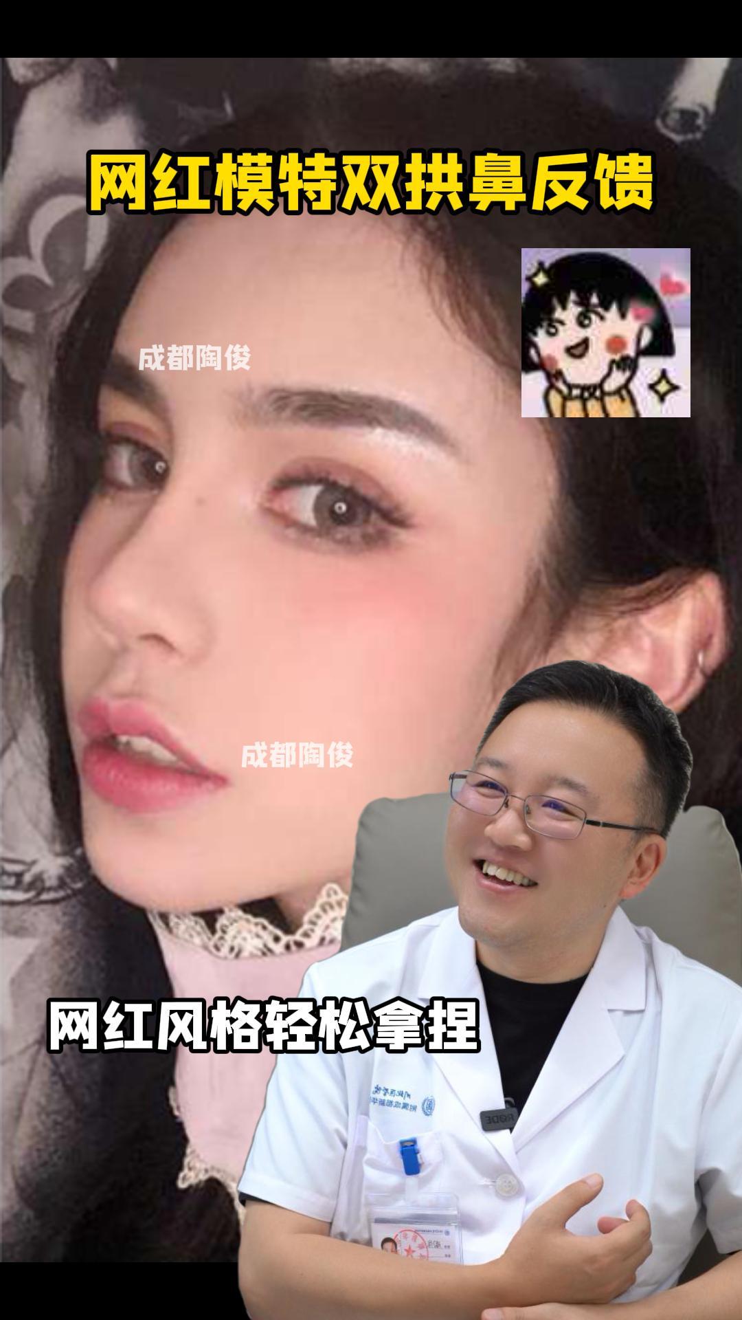 拱鼻图片