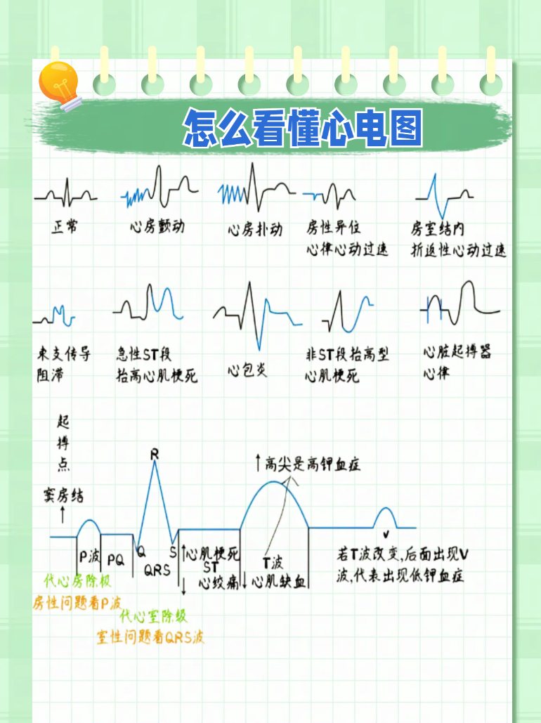 完全性右束支阻滞,入职受阻?真相揭秘!