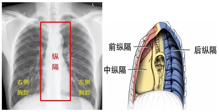 后纵膈图片