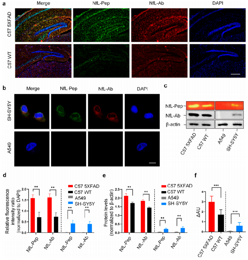 高通量筛选神经丝轻链自组装肽用于非侵入性阿尔茨海默病监测