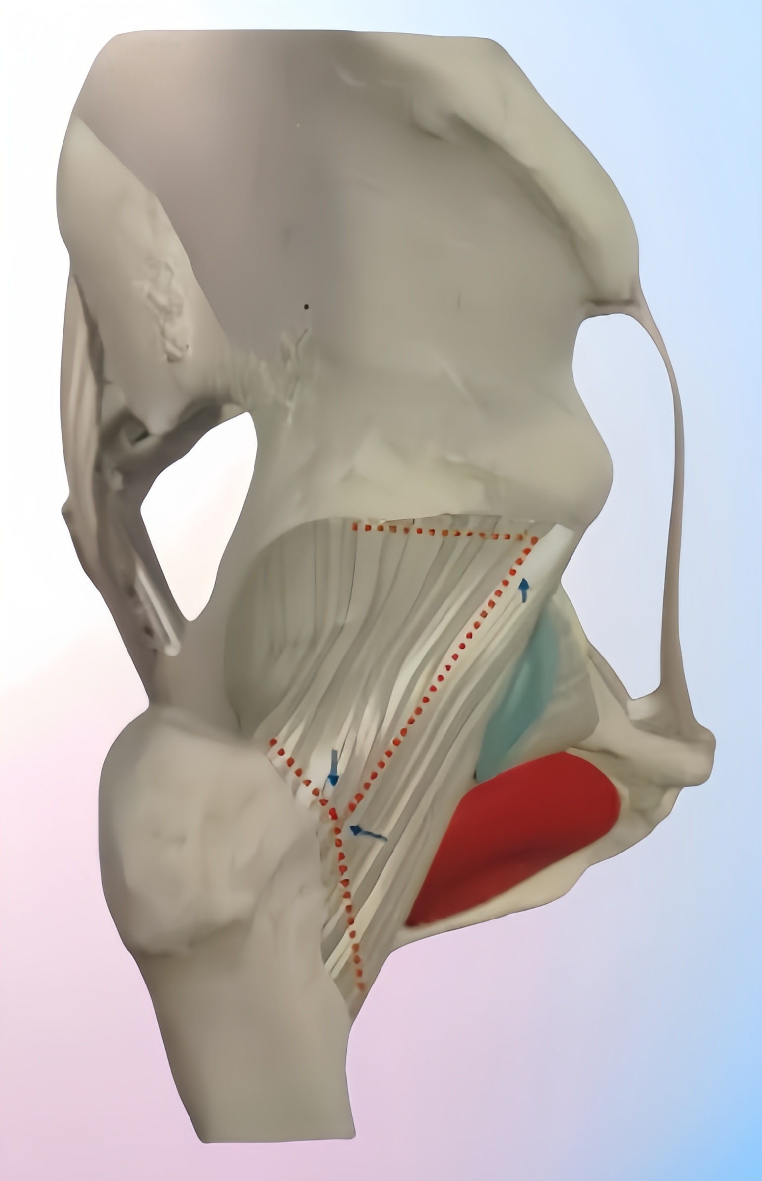 daa入路髋关节置换股骨侧松解顺序