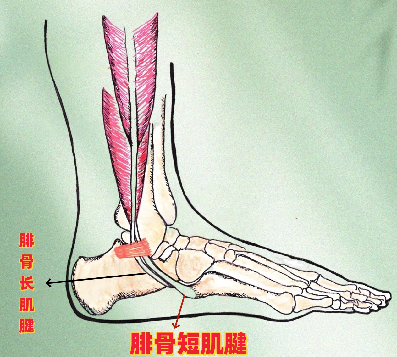腓骨长短肌腱滑脱