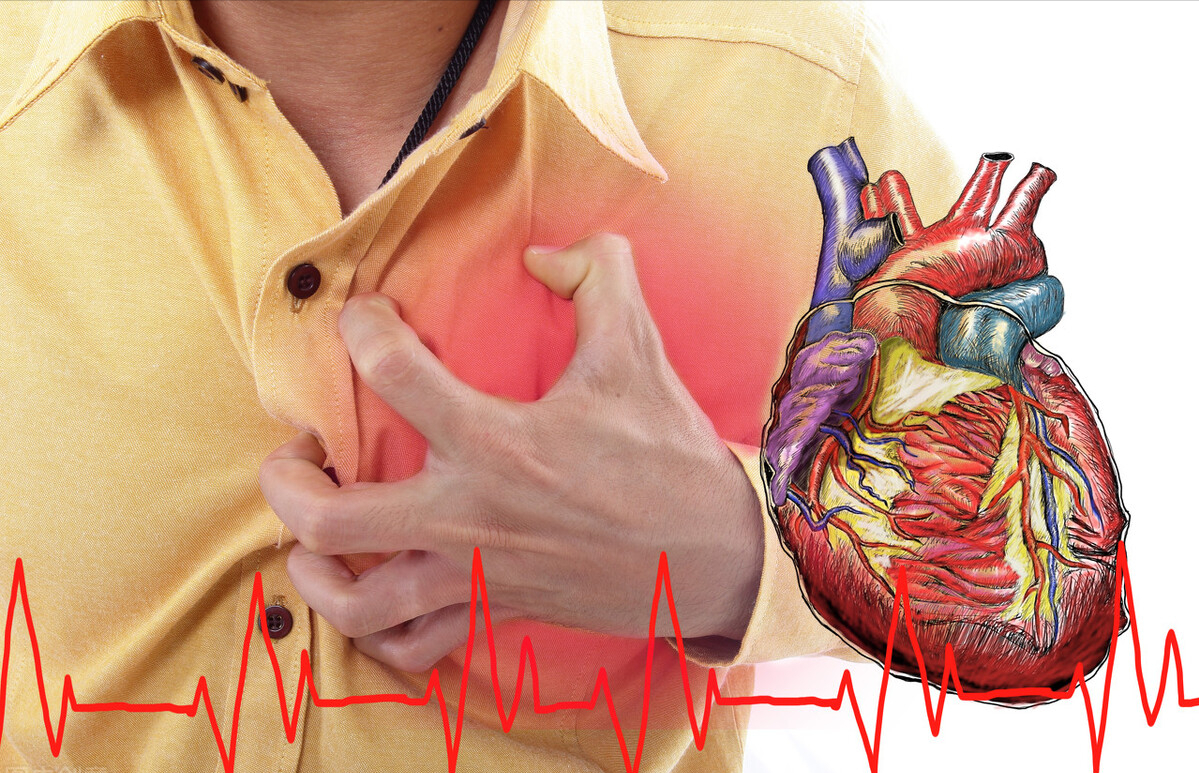 15种证型的心脑血管疾病,典型症状是什么?首选哪些经典中成药?