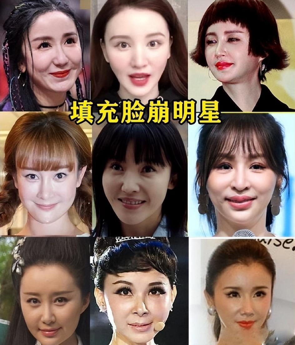 4位整容失败的女明星,个个都是"假脸",真是让人不忍直视