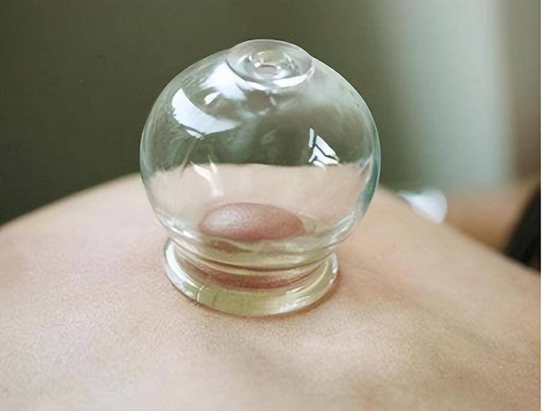 感染后有何症状?这几种传播途径,男女都要注意