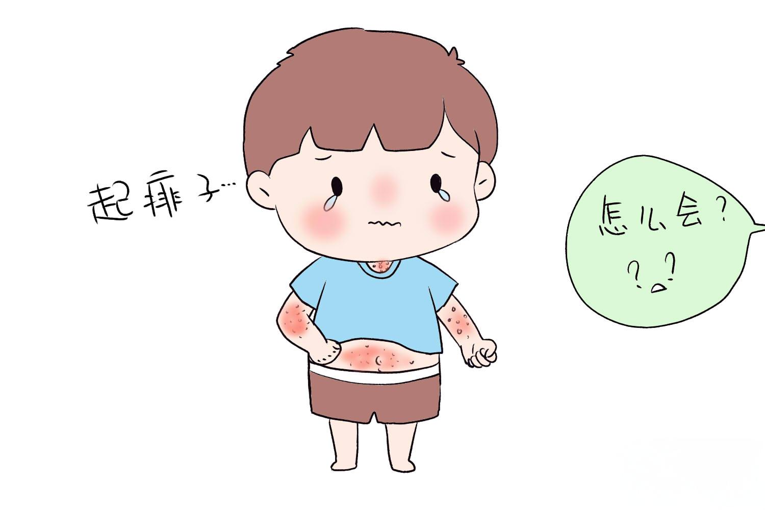 痱子的病因及典型表现