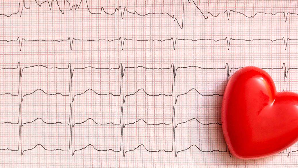 心律不齐是心脏病吗?早了解