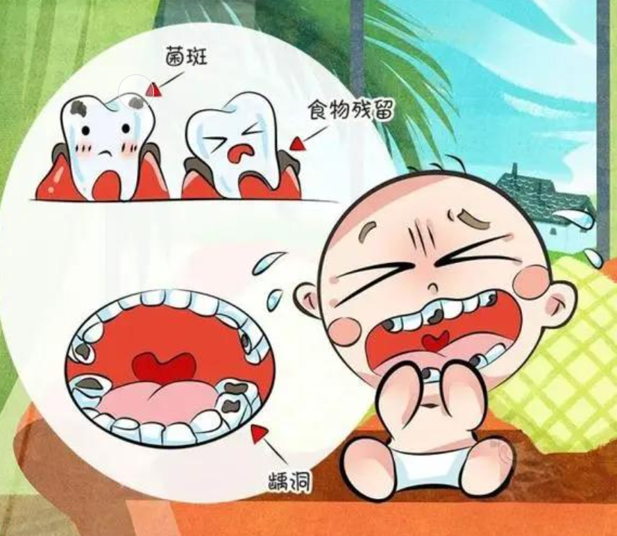 日常应该怎么预防孩子蛀牙呢?有哪些方法?
