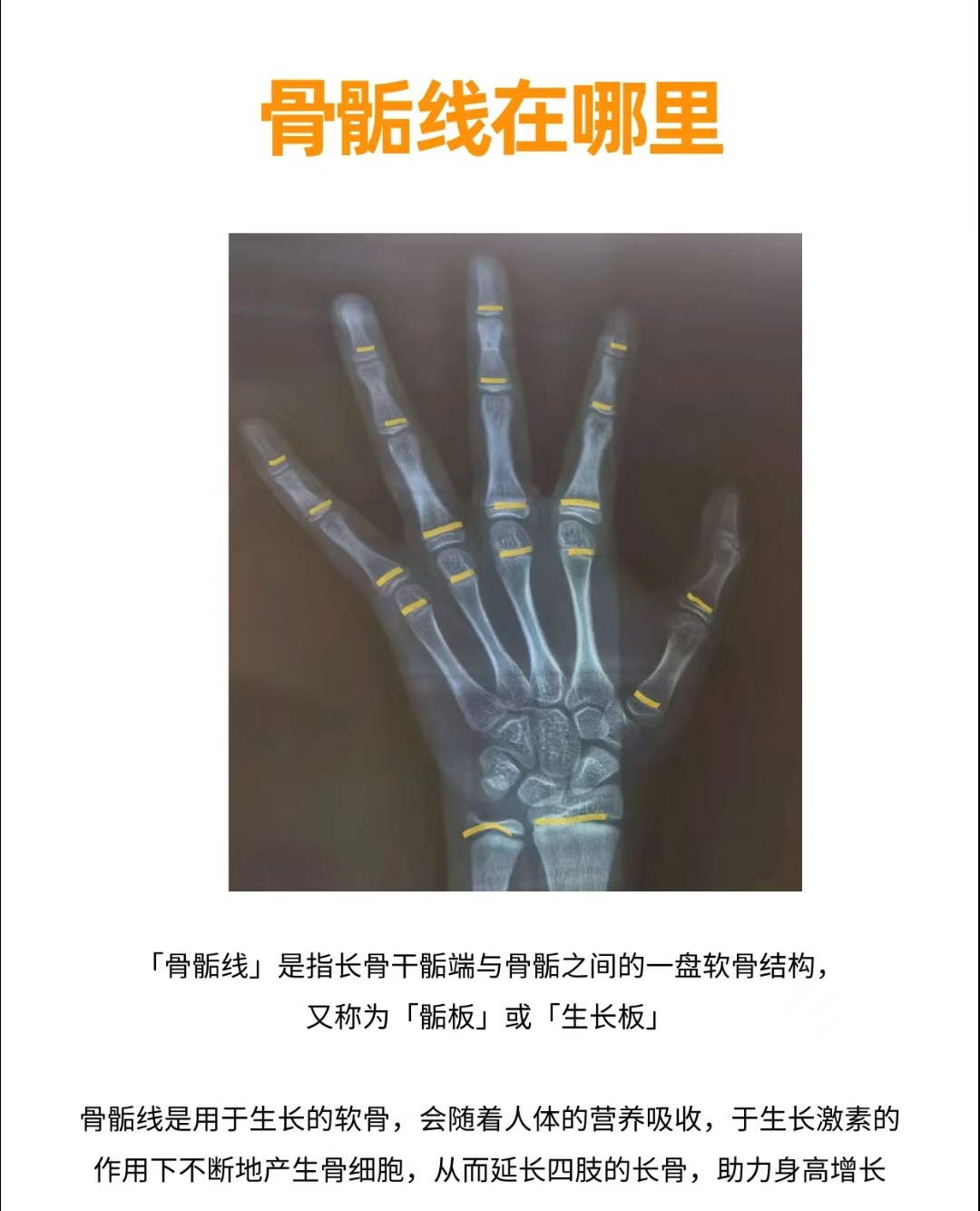 千万不要随便测骨龄