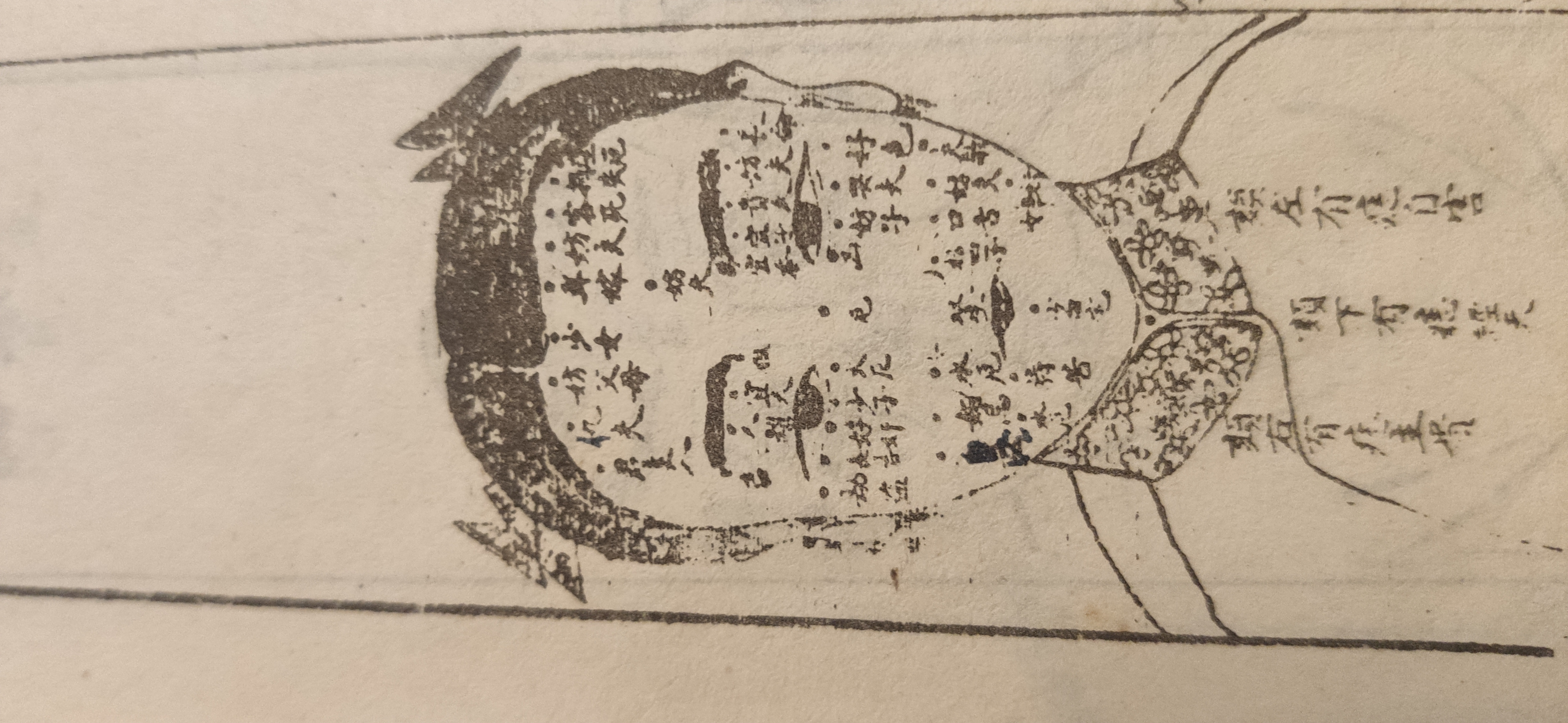 富贵双全的脚底痣新论